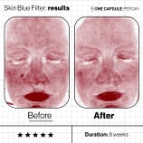 Skin-Blue-Filter-Before-And-Afters (4)