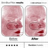 Skin-Blue-Filter-Before-And-Afters (5)