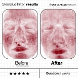 Skin-Blue-Filter-Before-And-Afters (6)