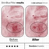 Skin-Blue-Filter-Before-And-Afters (7)