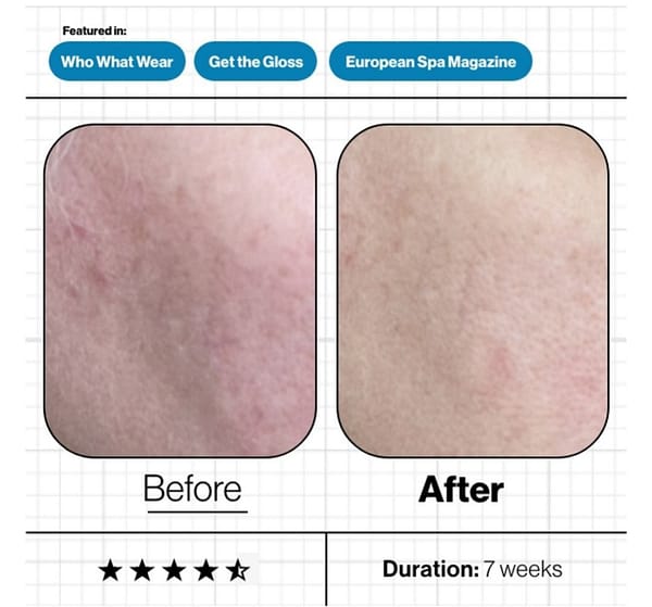 2022/02/1000076519.jpg 2022/02/1000076519.jpg