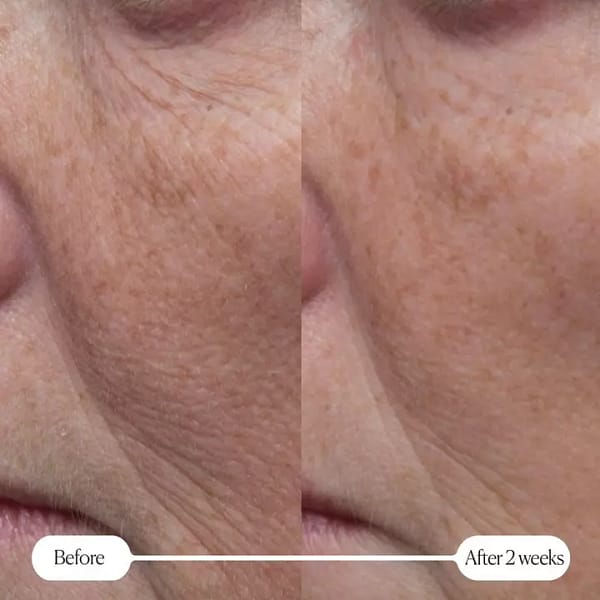 2605532_alt05 2605532_alt05