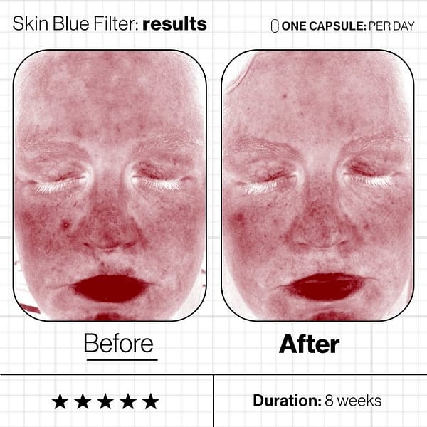 Skin-Blue-Filter-Before-And-Afters (4) Skin-Blue-Filter-Before-And-Afters (4)
