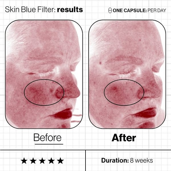 Skin-Blue-Filter-Before-And-Afters (5) Skin-Blue-Filter-Before-And-Afters (5)